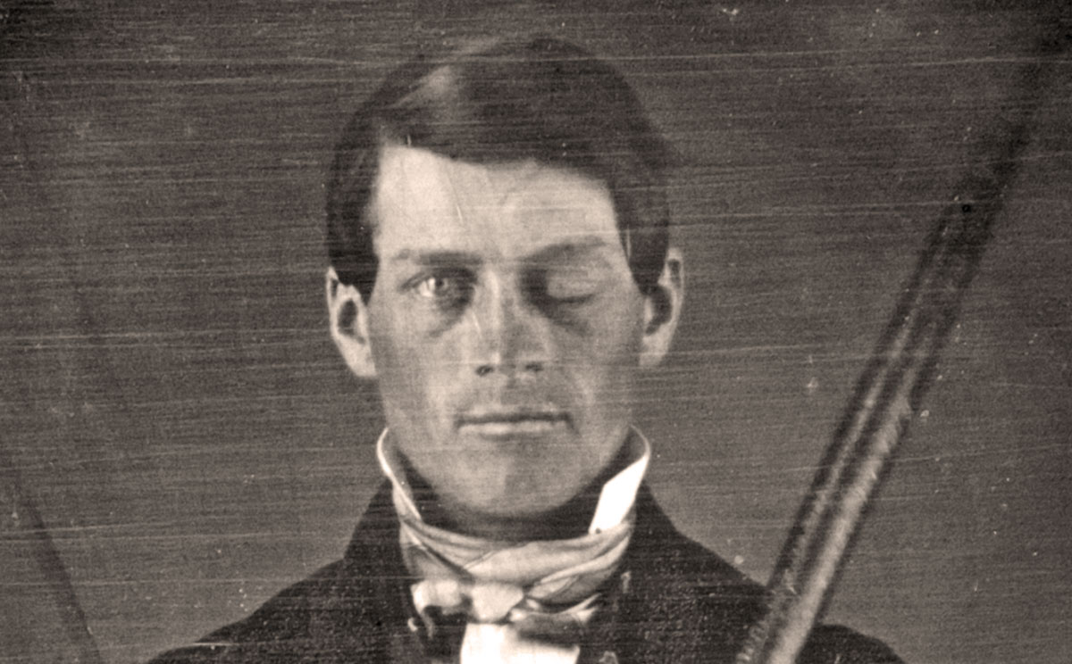Phineas Gage, on Second Thought.