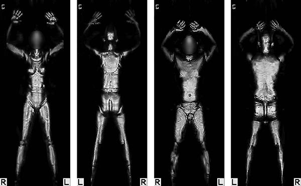 Student Questions: Airport X-Rays, Shampoo, and the Moon