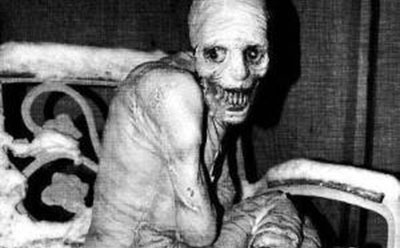 The Russian Sleep Experiment